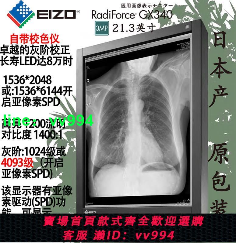 CR/DR醫用顯示器醫療EIZO藝卓灰階黑白GX530/GX340/GS320/520/521