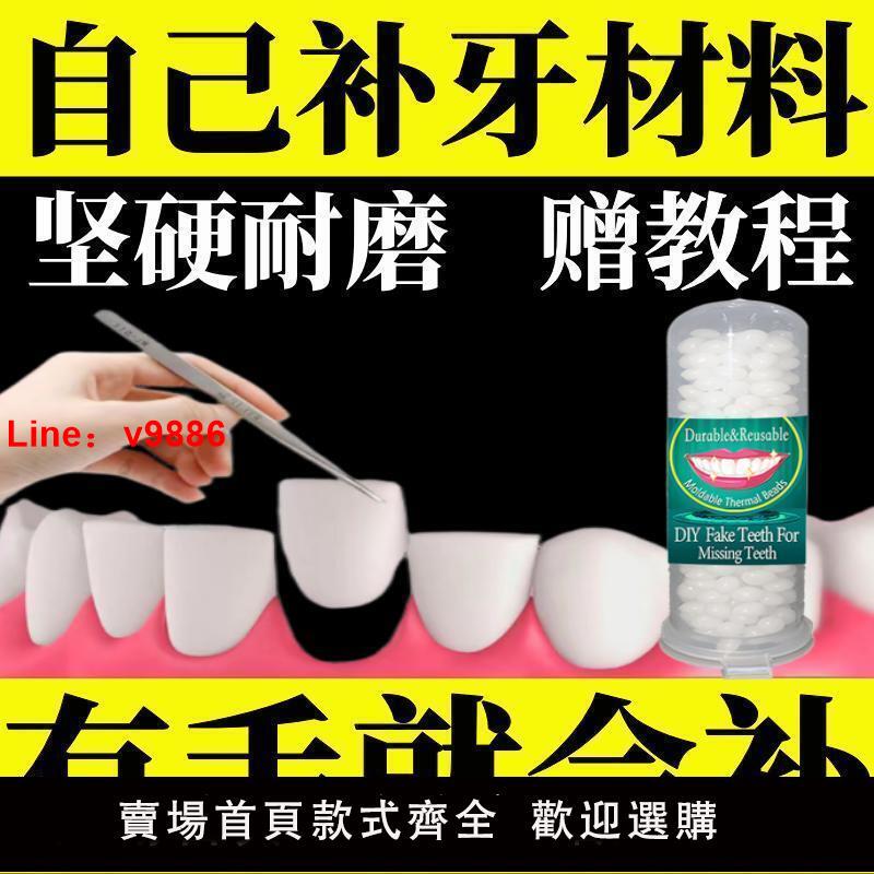 【台灣公司保固】顆粒補牙神器補牙材料永久自己動手牙齒補缺牙臨時假牙樹脂堵牙洞
