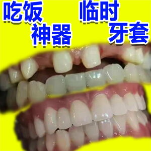 日本進口吃飯神器仿真假牙套牙專用臨時遮沒老人沒牙吃飯修復全包