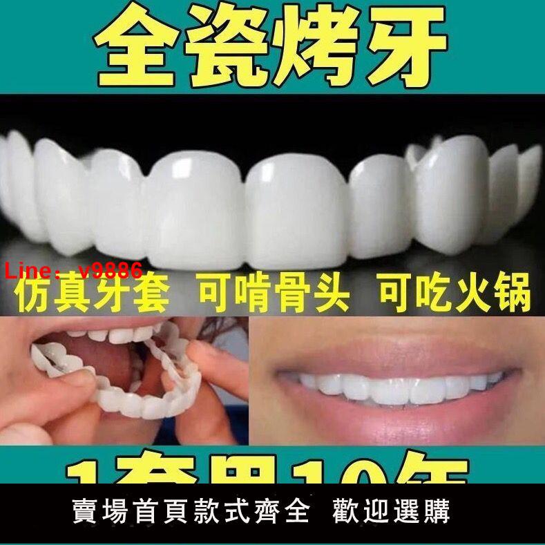 【台灣公司保固】萬能牙套吃飯神器老人通用補牙缺牙假牙自制無洞牙縫美白遮丑仿真
