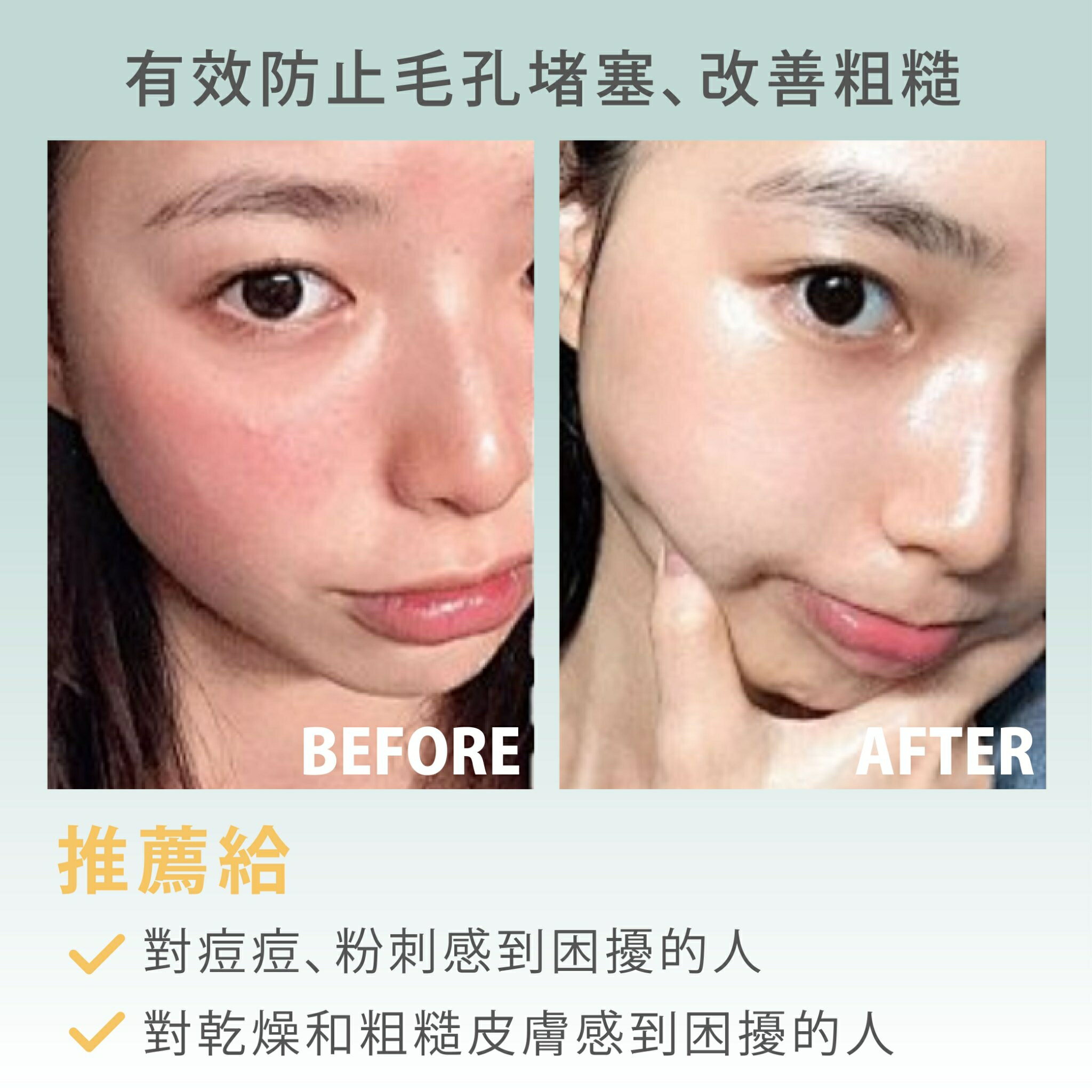 韓國面膜網友推薦【Hello, Morning】晨間痘痘面膜 30片/盒 水楊酸 早安面膜 60秒保養完成 保濕面膜 面膜 9