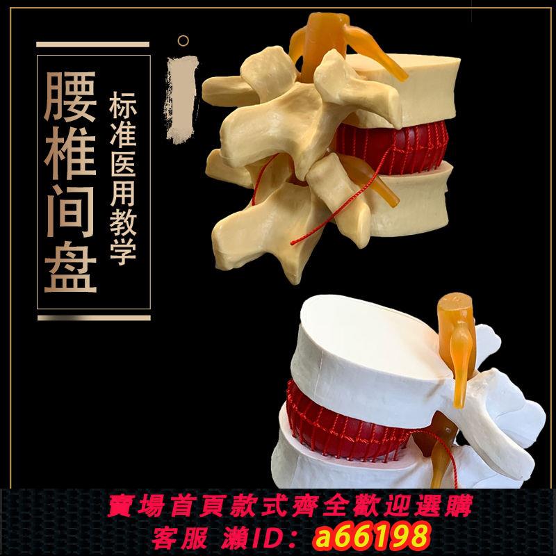 【臺灣公司 可開發票】包郵!人體腰椎間盤演示模型 腰椎模型 脊柱模型 脊椎模型關節模型