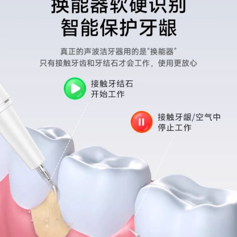 超聲波洗牙器家用潔牙儀沖牙結石去除神器牙齒清潔污垢除牙垢847-樂購
