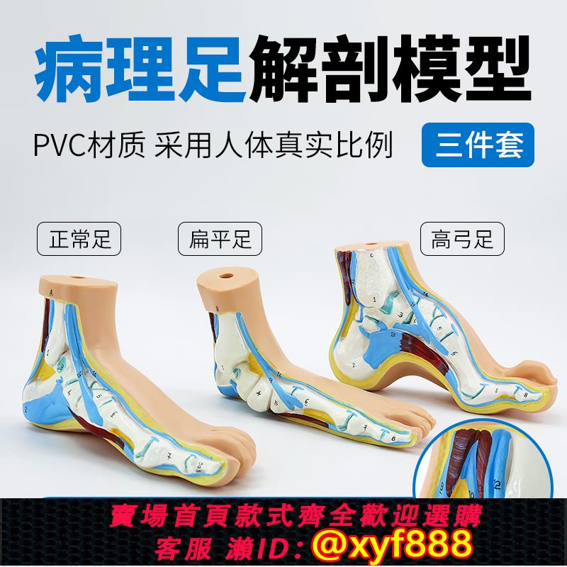 {可打統編 保固一年}正常足 扁平足 弓型足 模型 足部病理模型人體足部肌肉解剖模型
