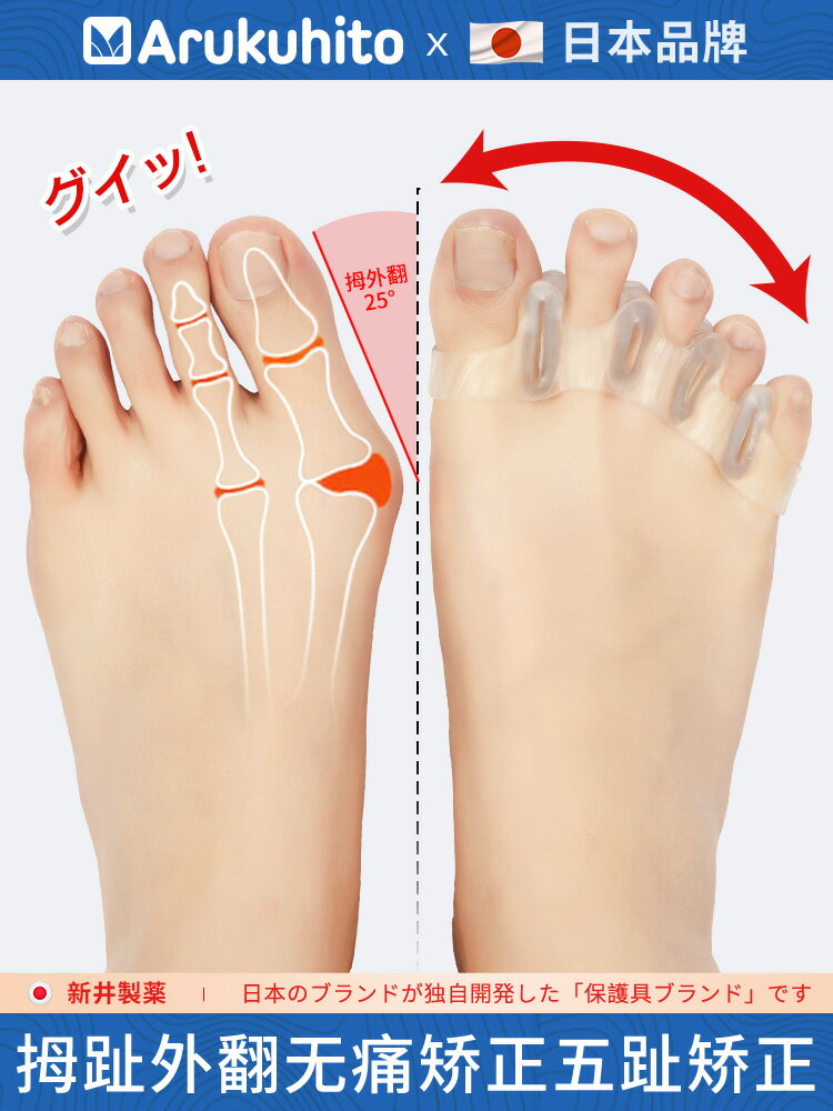 日本品牌拇指外翻矯正器重疊趾分離器小腳趾外翻矯正器瑜伽分趾器