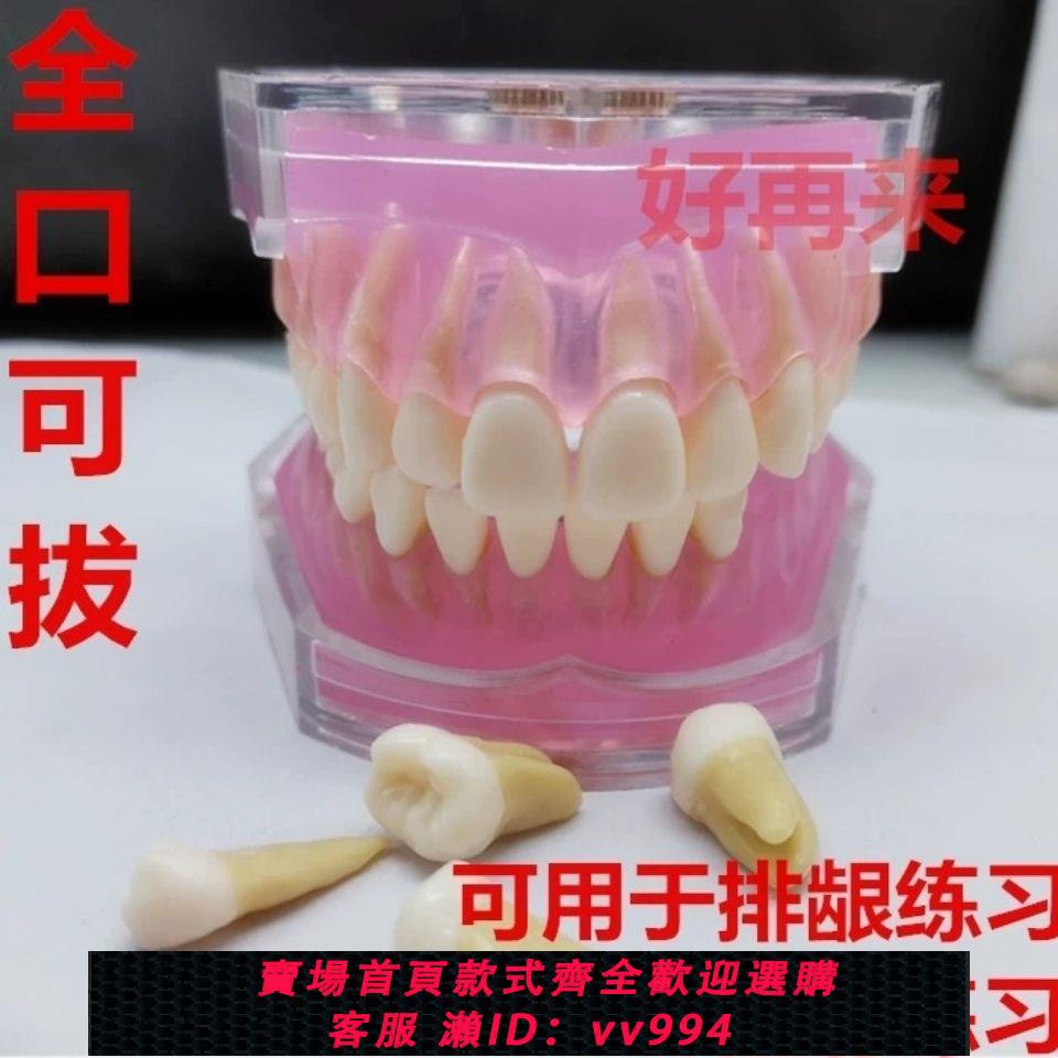{公司貨 最低價}牙科模型口腔科教學模型 練習拔牙模型拆卸牙齒 軟牙齦 全口可拔