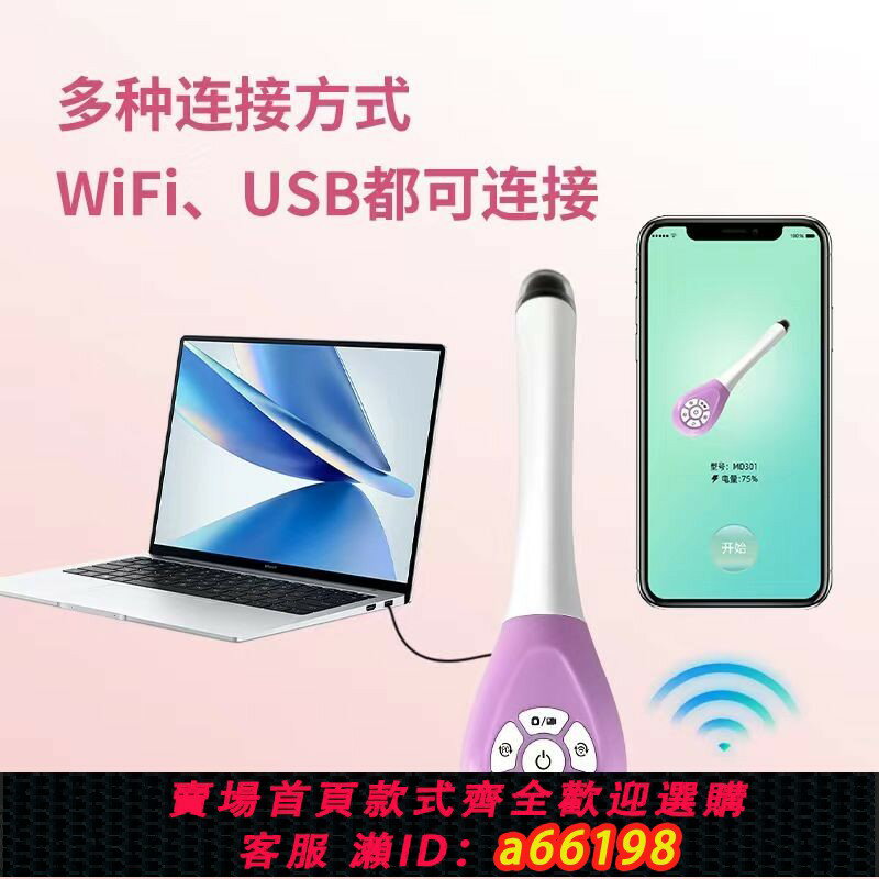 【臺灣公司 可開發票】【3485人收藏】陰道鏡高畫質宮頸醫用內窺檢測儀婦婦科電子科私密帶燈自檢鏡家用