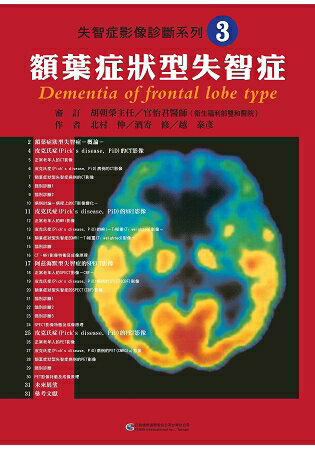 失智症影像診斷系列3 額葉症狀型失智症 | 拾書所