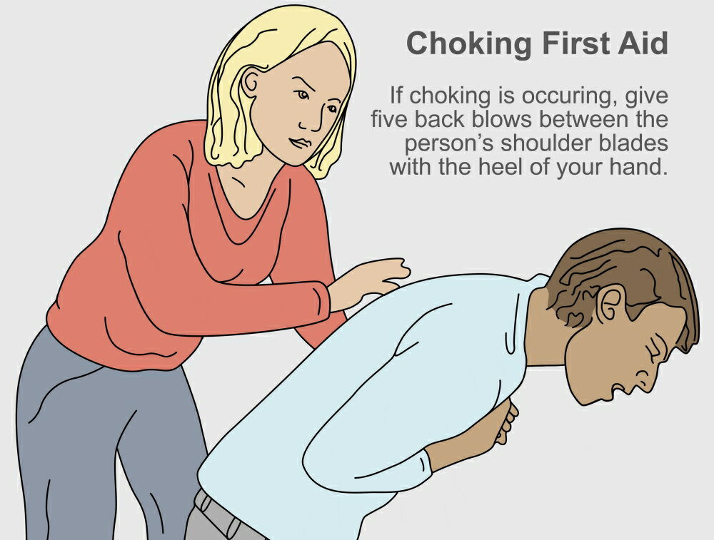 Posterazzi Choking First Aid Poster Print By Gwen Shockeyscience 