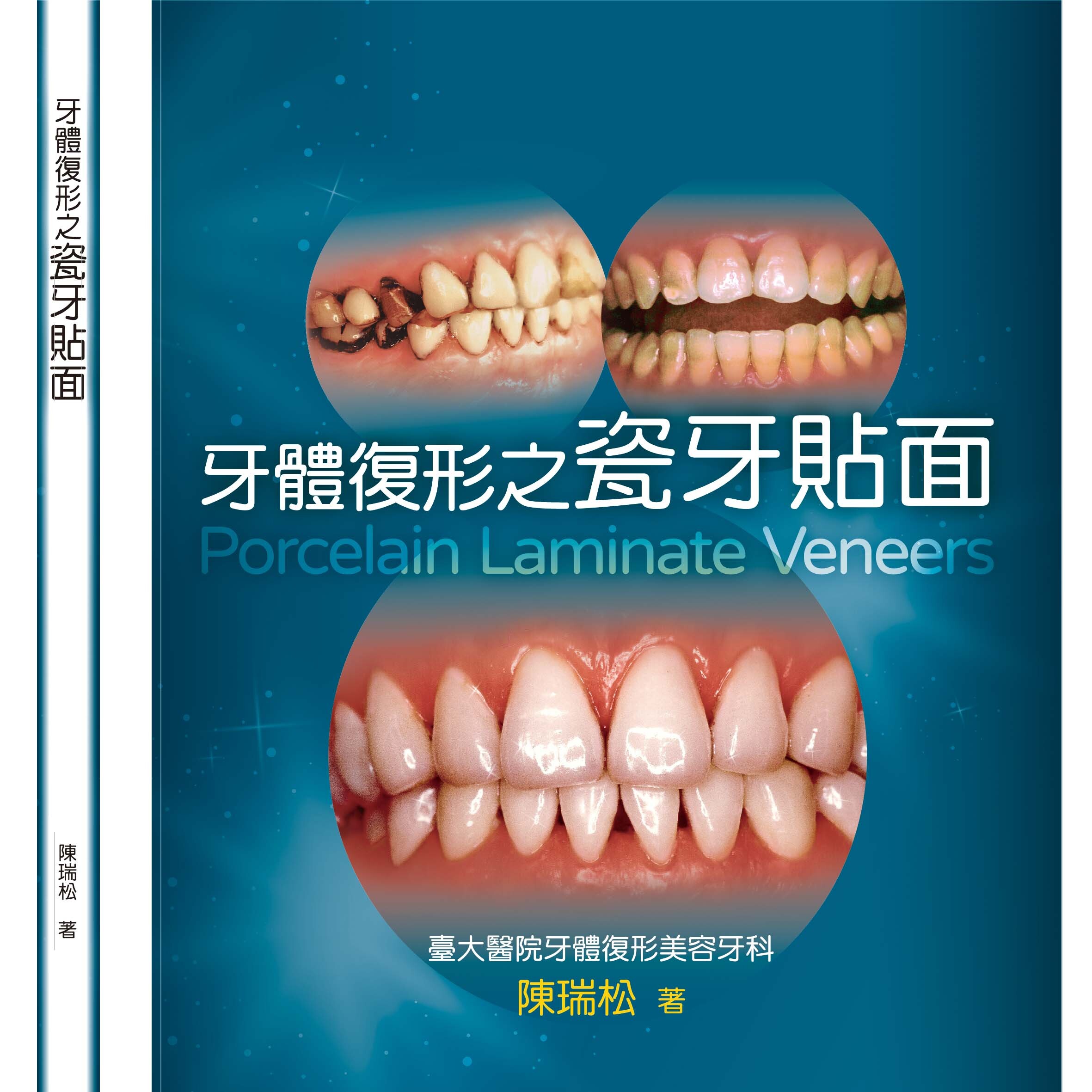 牙體復形之瓷牙貼面 (1版) 陳瑞松  金名
