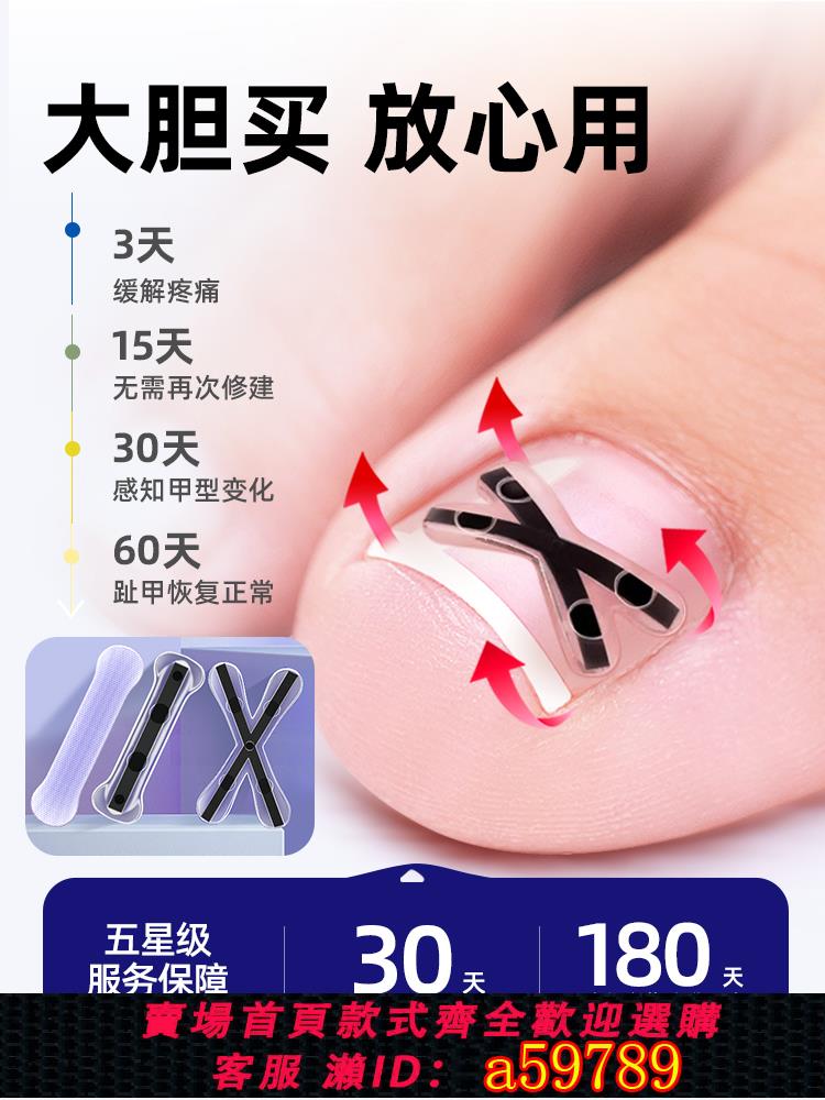 【臺灣公司 可打統編】德國BORSU甲溝嵌甲炎矯正器正甲貼片腳趾指甲刀剪往肉裡長專用貼