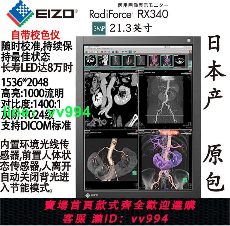 2M/3M/5M醫用顯示器MRI/CR/CT藝卓EIZO醫療彩色MX215/RX320/340