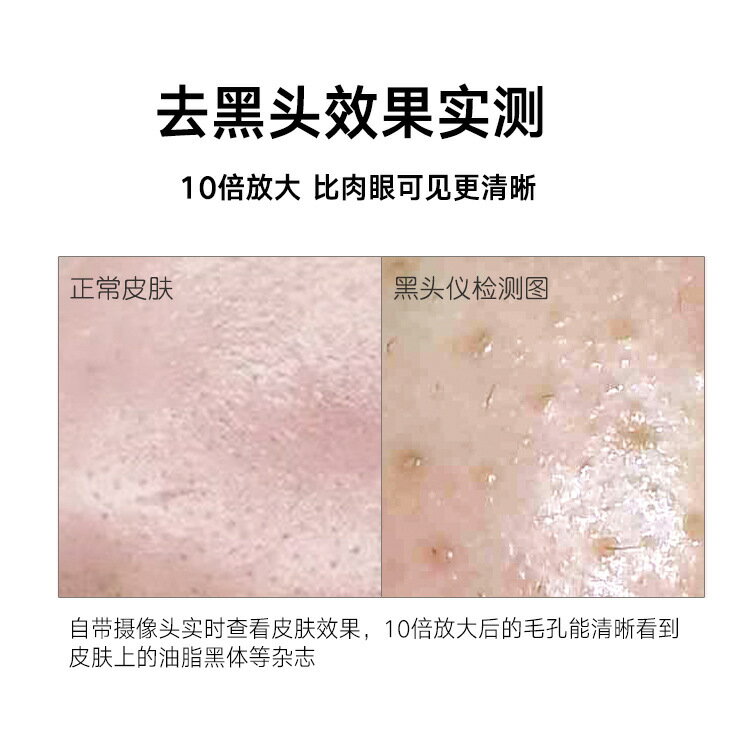 免運 特惠電動黑頭儀去黑頭 去粉刺 美容潔面儀器 可視化神器洗臉機 毛孔儀 2