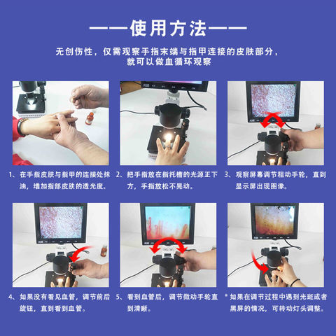 {公司貨 最低價}專業高清微循環檢測儀手指甲壁末梢血液流速檢測廠家直銷批發 3