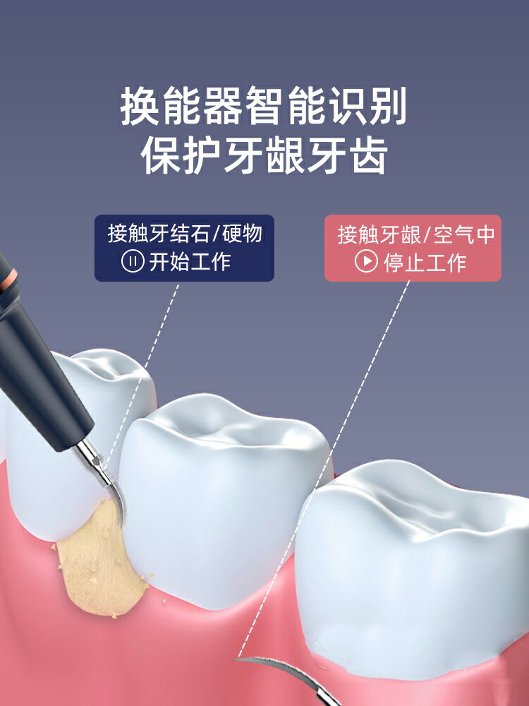 專業洗牙器聲波潔牙儀牙結石去除神器洗牙齒污垢電動除牙垢牙石。-樂購