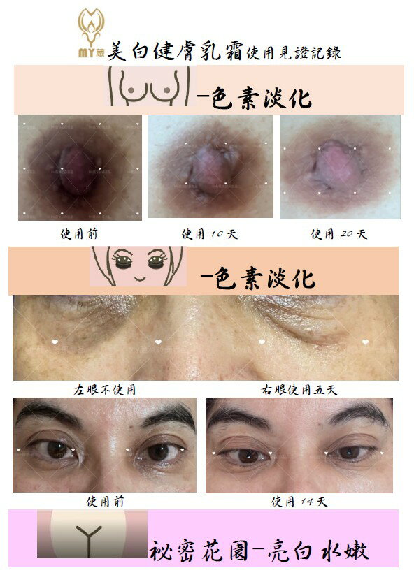強效美白-內白外防曬禮盒 Super Strong Whitening & Sunscreen Set 1
