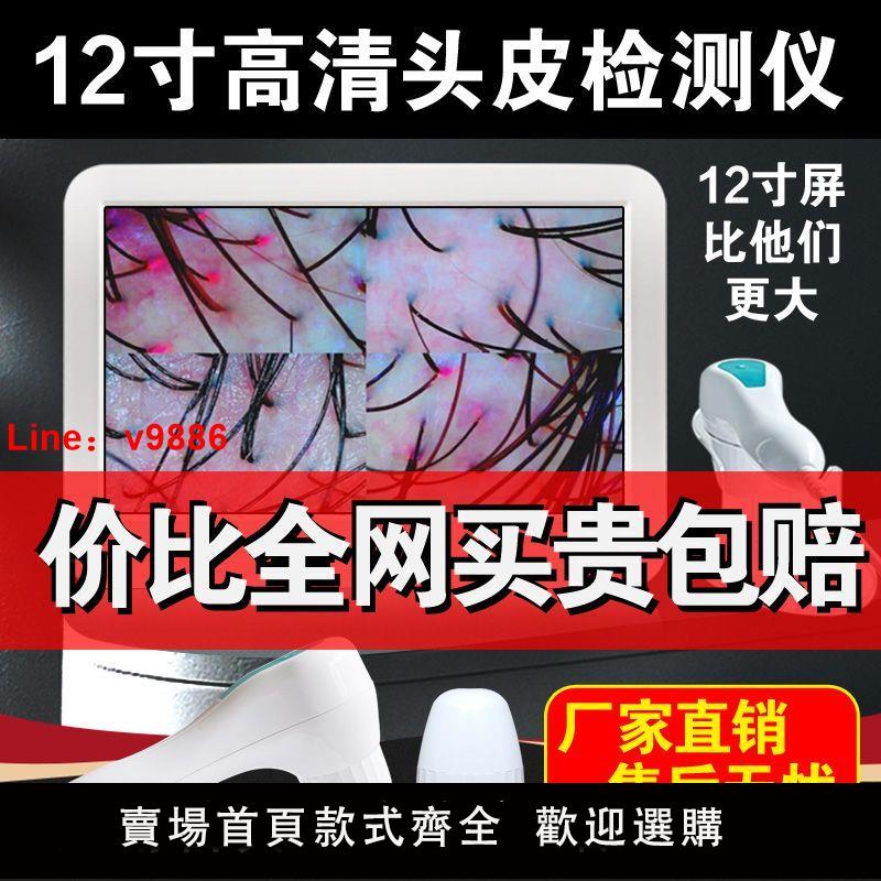 【諮詢客服有驚喜】頭皮檢測儀毛囊高清理發店頭發測試儀器皮膚智慧分析帶螢幕一體機