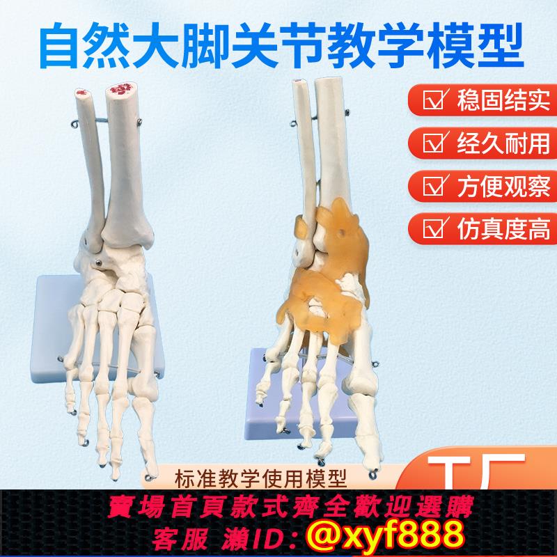 {可打統編 保固一年}腳關節模型 仿真人體踝關節模型 帶韌帶 腳骨標本模型 教學用醫用