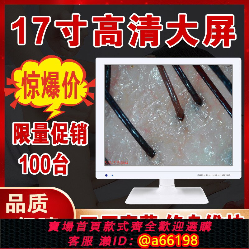 【臺灣公司 可開發票】頭皮檢測儀毛囊高畫質頭發測試儀器皮膚面部分析理發店帶螢幕一體機
