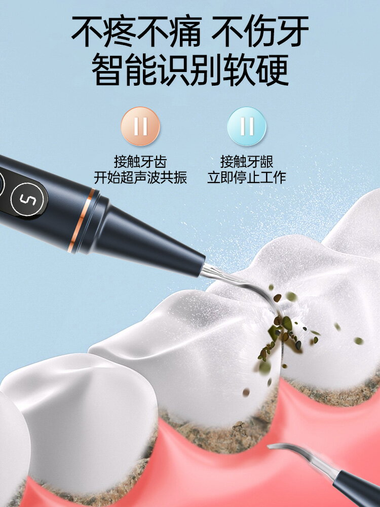超聲波洗牙器潔牙儀沖牙結石去除神器牙齒清潔污垢除牙垢牙石速效-樂購