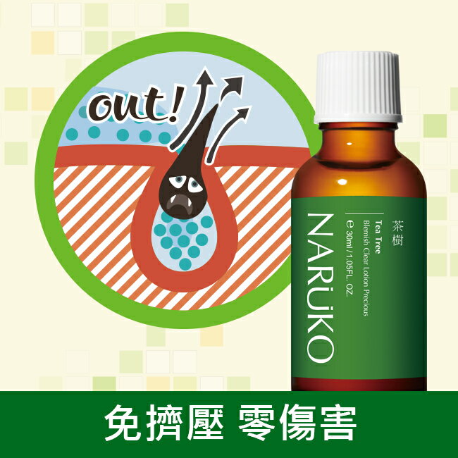 NARUKO 茶樹抗痘粉刺寶30ml