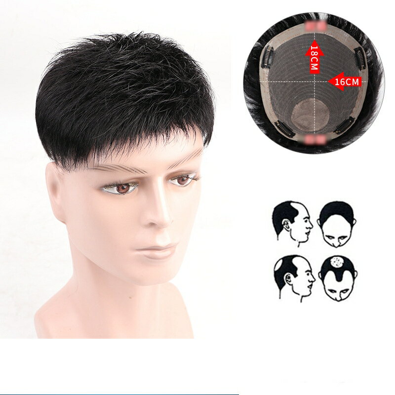 現貨+預購 補髮塊全真髮男假髮透氣假髮片輕量免打理隱形增髮量假髮接髮-遞針頭旋4款74kb35【獨家進口】【米蘭精品】