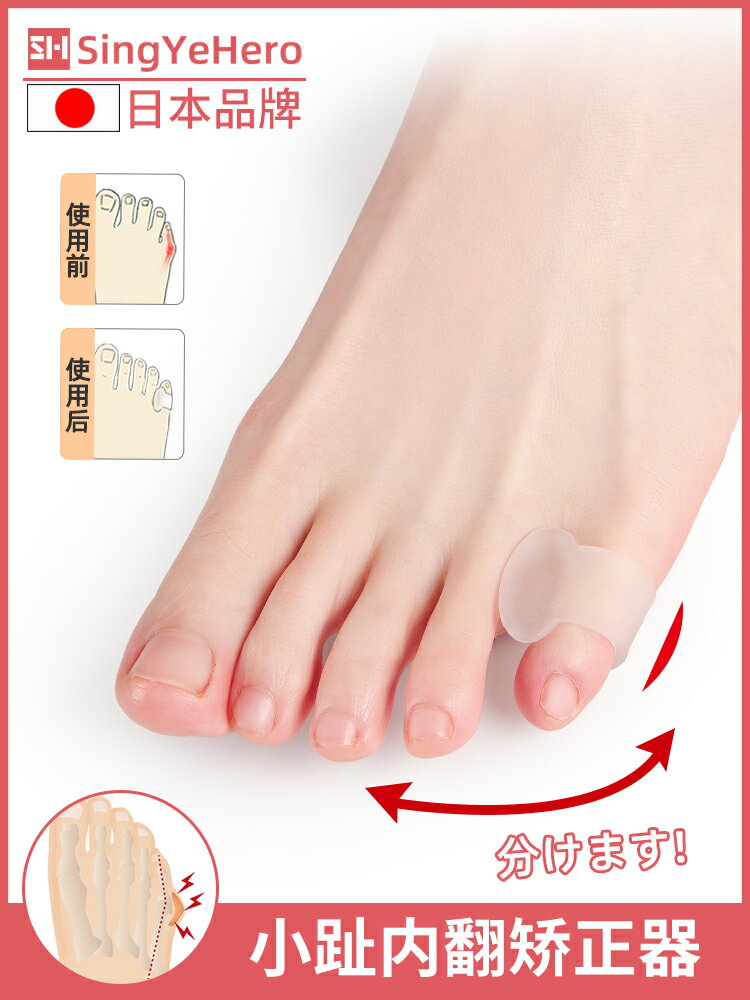 日本小腳趾內外翻矯正器小拇指外翻分趾器腳趾分離器可以穿鞋男女