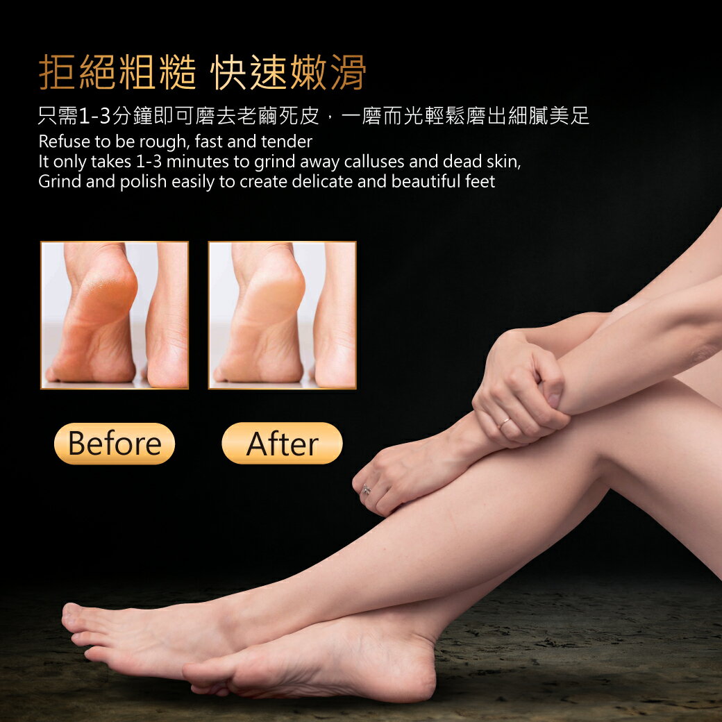 【ME5】C008 微米腳皮銼 5