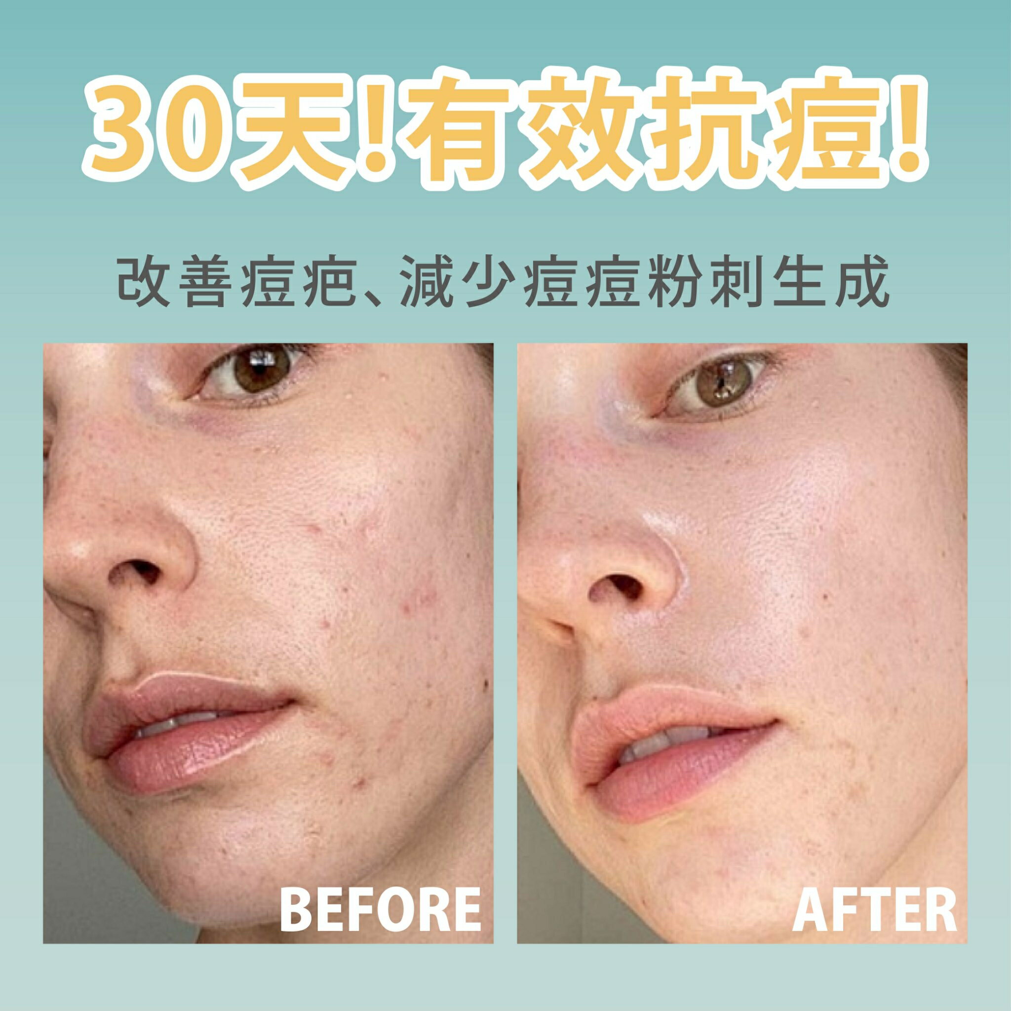 韓國面膜網友推薦【Hello, Morning】晨間痘痘面膜 30片/盒 水楊酸 早安面膜 60秒保養完成 保濕面膜 面膜 8