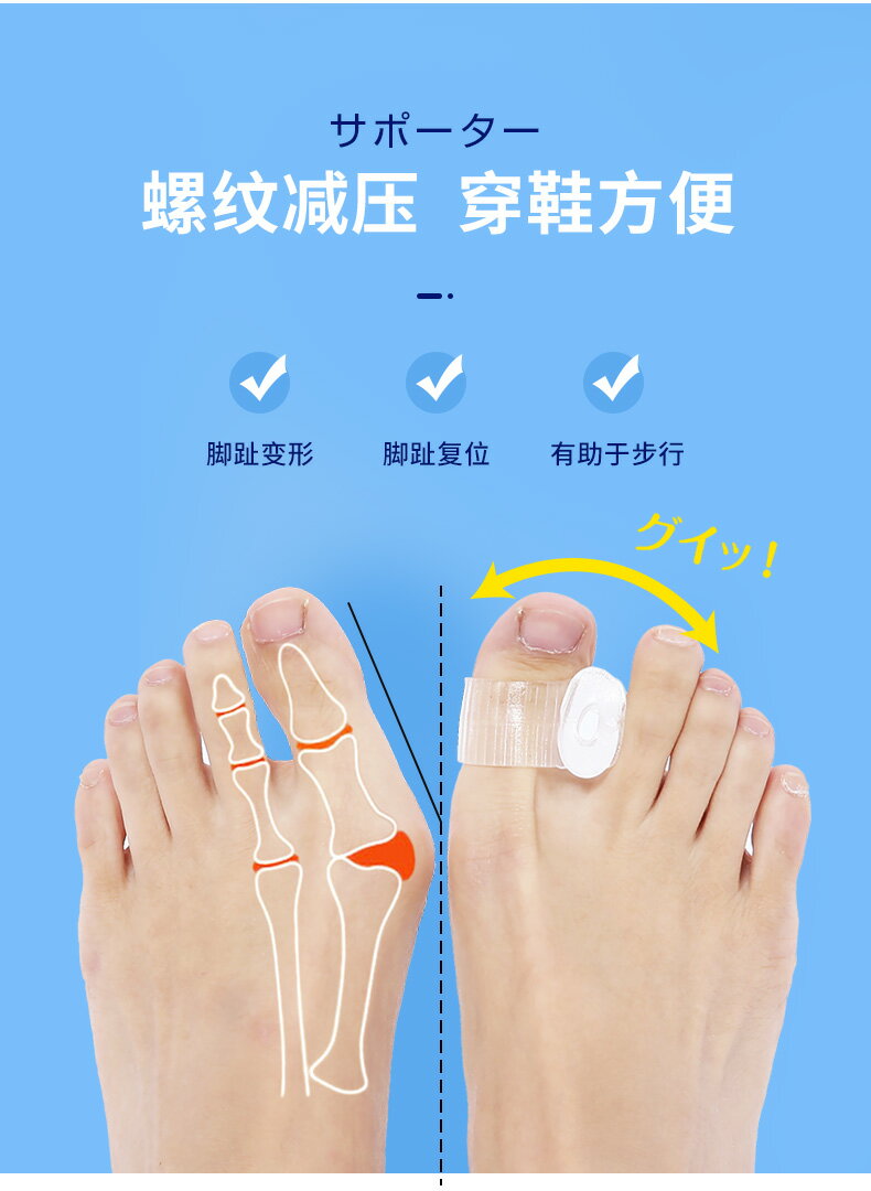 【可開發票】一對裝 拇指外翻矯正器 還妳漂亮美腳 日夜使用方便 可穿鞋 7