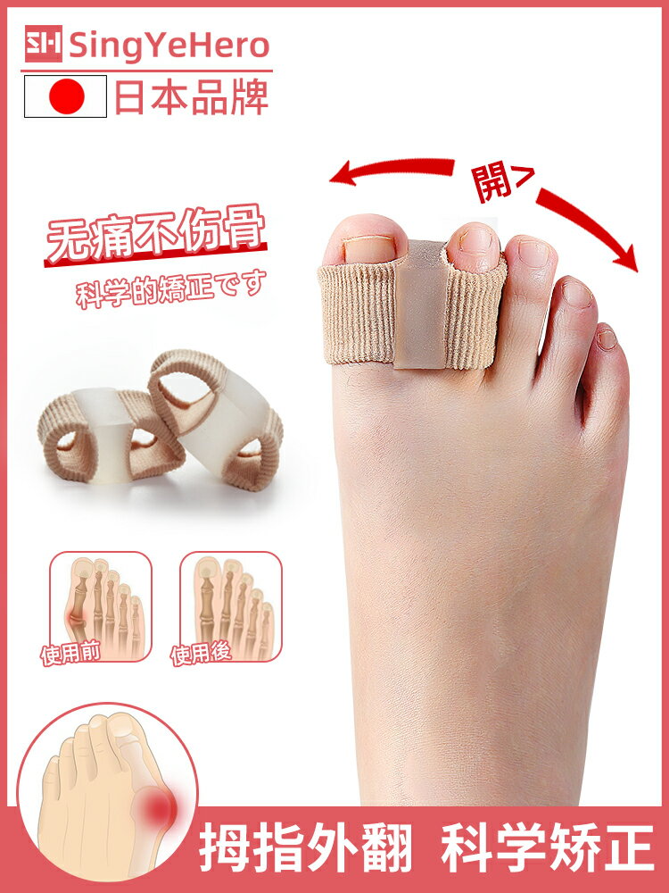 日本拇指外翻矯正器腳趾雙環分趾器姆外翻可穿鞋男女士大腳骨糾正