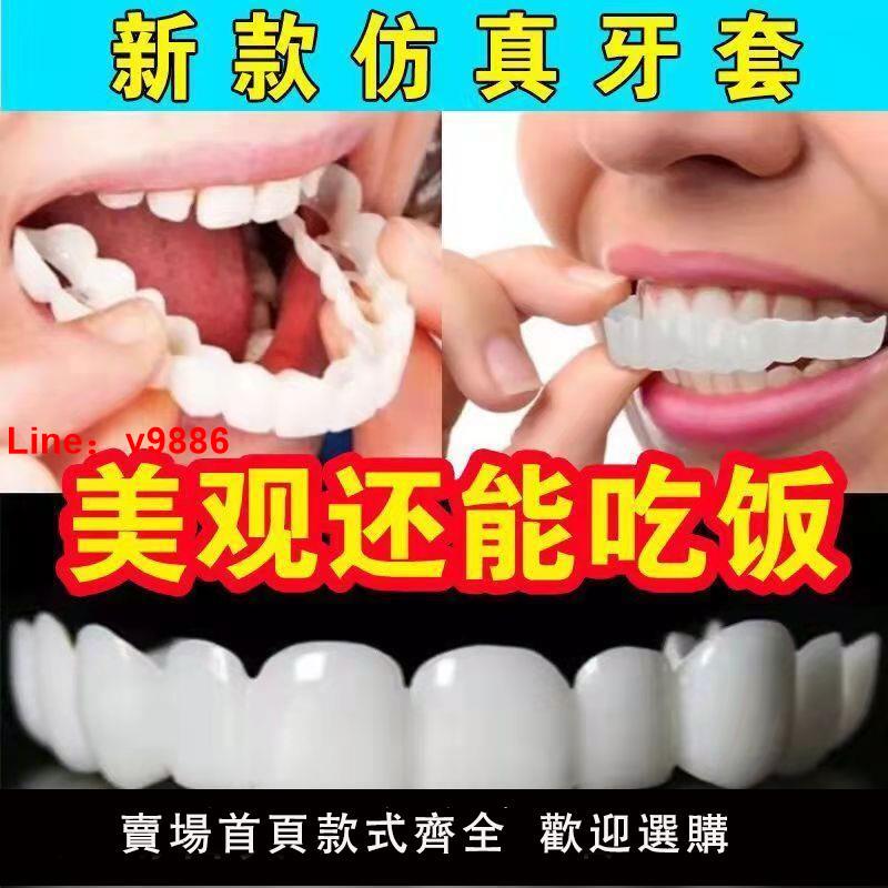 【台灣公司保固】2022新款仿真牙套通用老人吃飯固齒假牙缺牙填充牙縫補牙塑形牙套