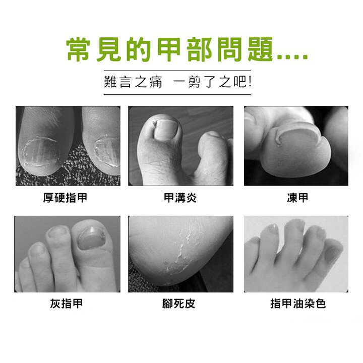 [現貨] 腳趾/指甲 嵌甲 凍甲 指甲剪 死皮剪 指甲 剪刀 嵌甲死皮剪 指甲刀/鉗/剪  加長款專業鷹嘴甲溝鉗剪指甲刀 6