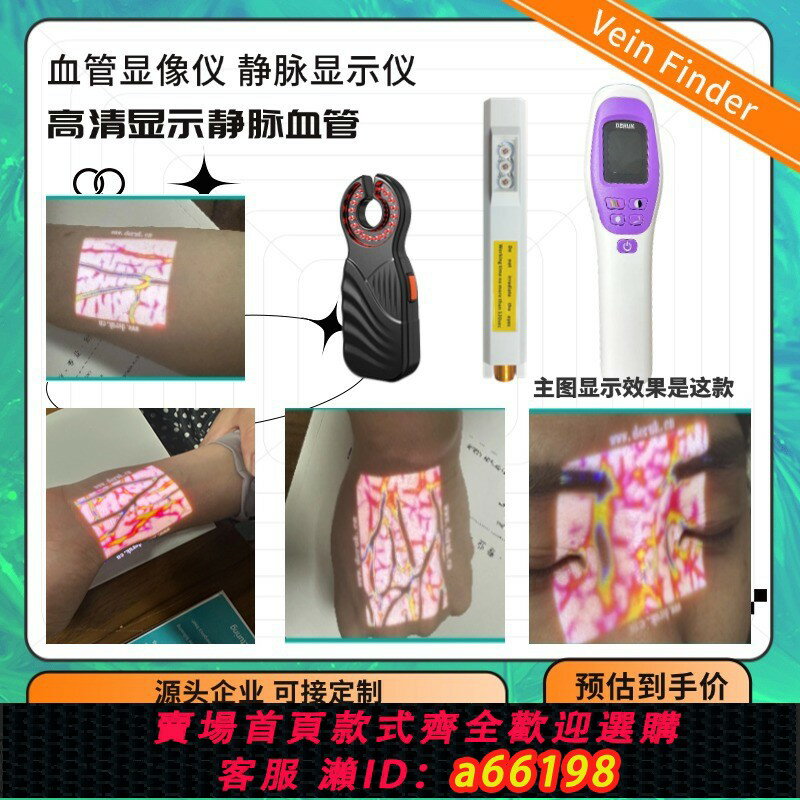 【台灣公司 可開發票】靜脈血管顯像儀四肢面部顯示儀輸液醫美醫用血管查詢儀顯影儀外貿