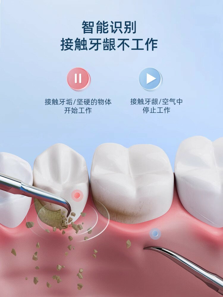 超聲波洗牙器潔牙儀家用電動牙齒結石清潔污垢沖去除牙石牙垢神器-樂購