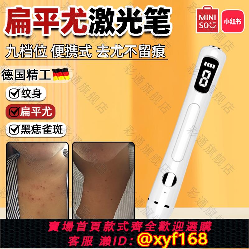 {可打統編 保固一年}德國去扁平疣激光筆神器電離子點痣祛斑瘊子脖子小肉粒去除儀器bl
