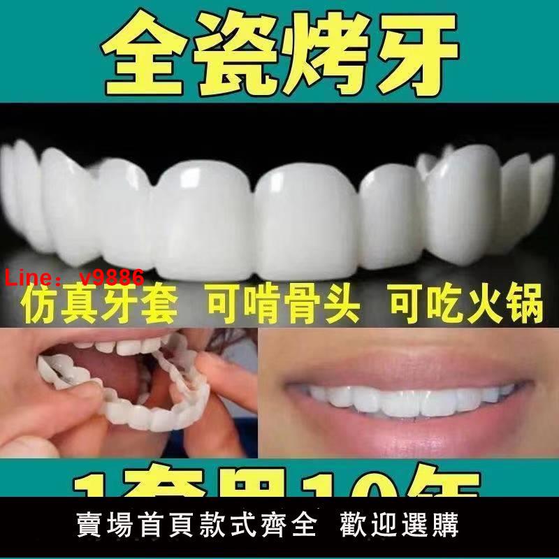 【台灣公司保固】【可用10年】萬能牙套仿真假牙吃飯神器美白缺牙蛀牙男女通用牙套