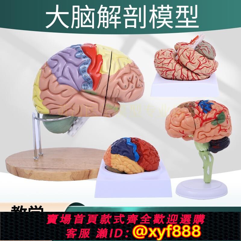 {可打統編 保固一年}大腦解剖模型 人體腦動脈構造 腦神經 腦模具 醫學腦功能區域色分