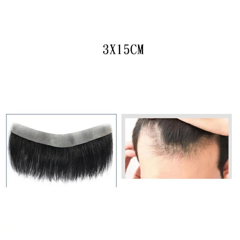 現貨+預購 男女假髮髮片全真髮透氣假髮片輕量假髮免打理隱形增髮量假髮接髮-前額補髮2款74kb5【獨家進口】【米蘭精品】