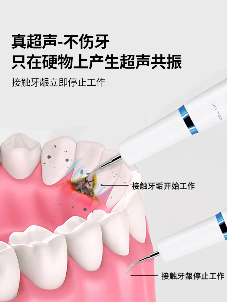 洗牙器超聲波家用牙結石去除器清牙垢洗牙齒污垢除牙石潔牙儀神器-樂購