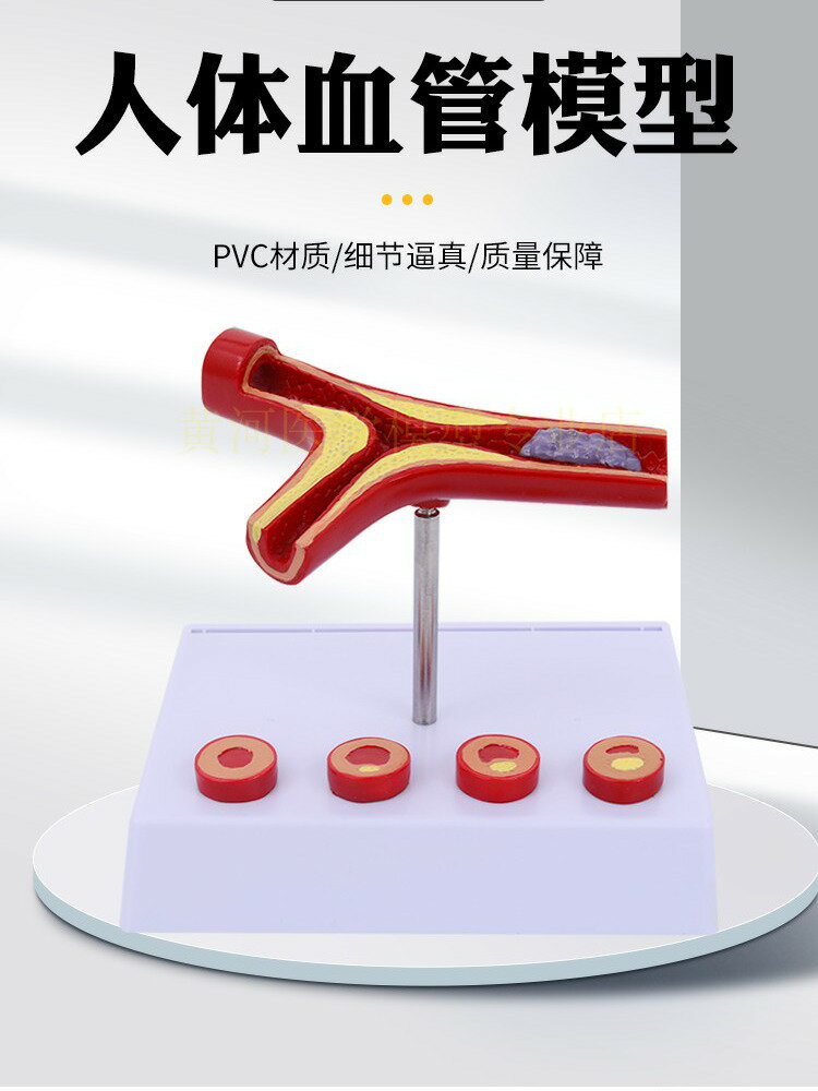 {可打統編 保固一年}血栓模型 人體支脈粥樣 硬化動脈心血管 各階段年齡血管展示模型