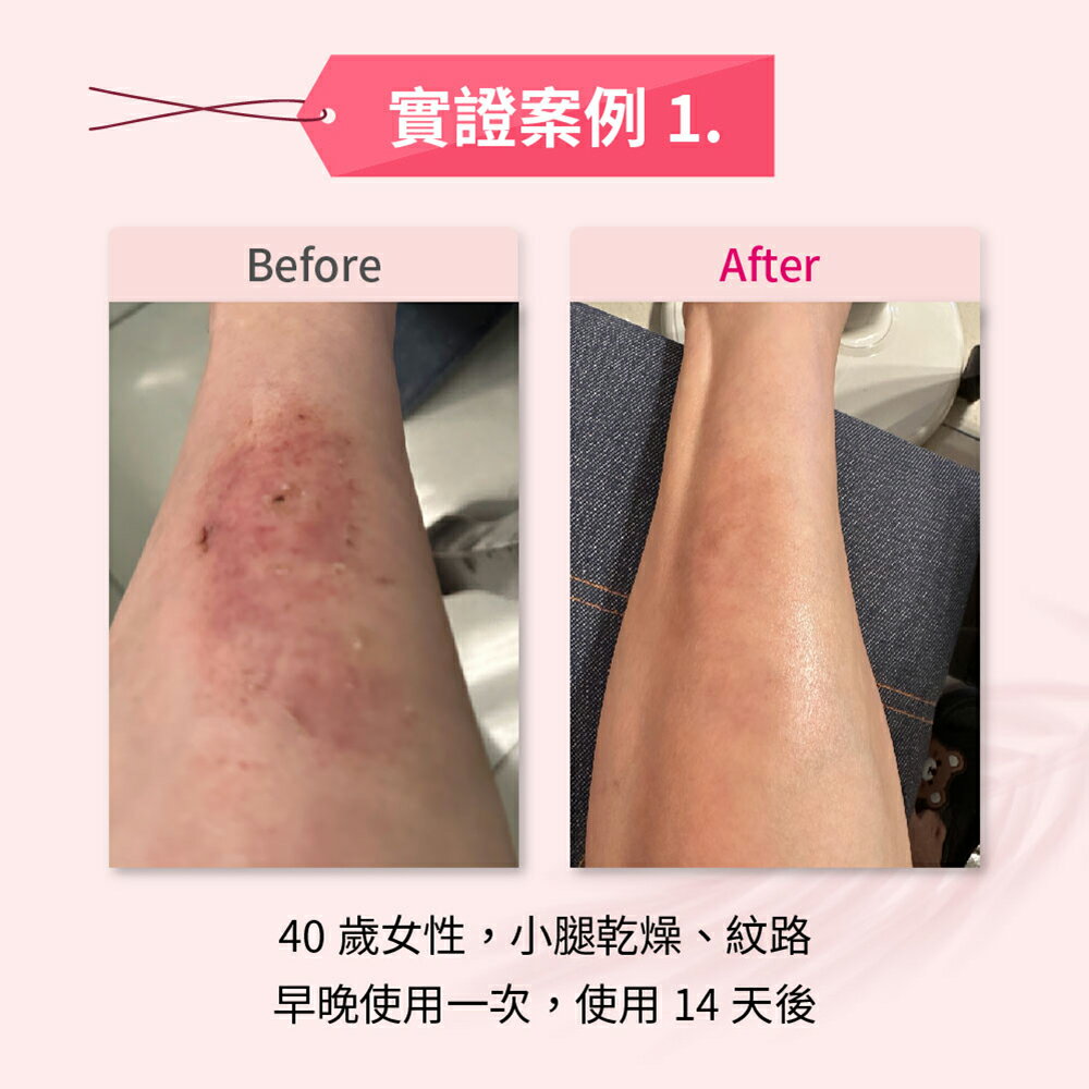 ＵＴＯ｜Repavar 芮培菈®玫瑰果油噴劑 90ml 台灣公司貨/開立發票 7