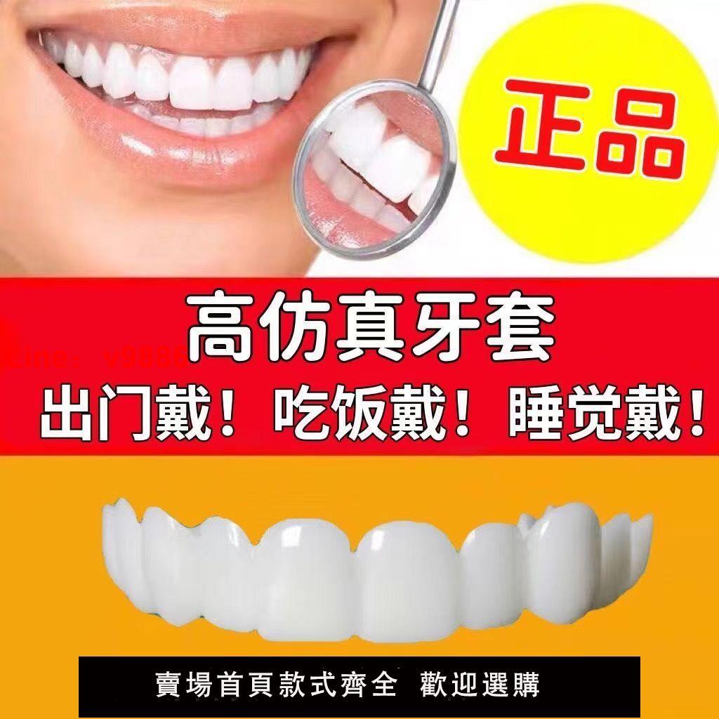 【台灣公司保固】仿真牙套假牙美白臨時牙套老人吃飯咀嚼神器通用遮蓋無孔缺牙補牙