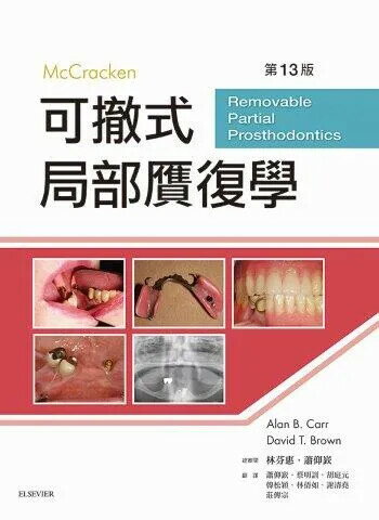McCracken 可撤式局部膺復學 (13版) 林芬惠  合記