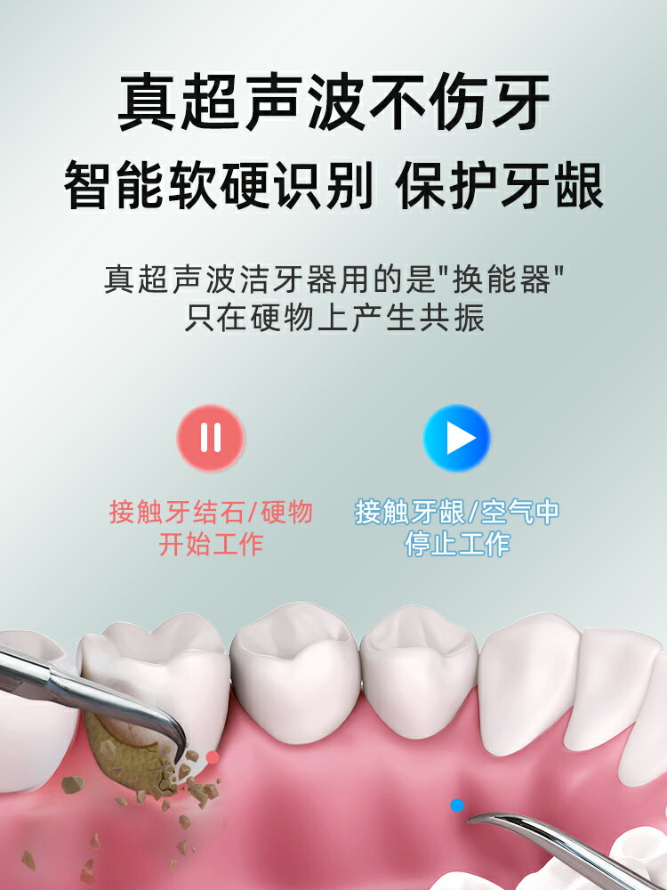 KMC超聲波洗牙器牙結石去除器家用洗牙齒污垢除牙石牙垢潔牙神器-樂購