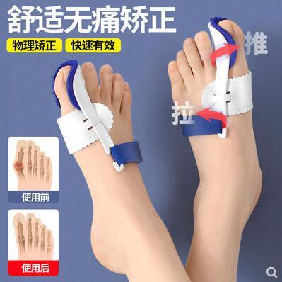 【可開發票】拇外翻矯正器腳趾外翻大拇指外翻內翻大腳骨足外翻腳趾重疊矯正器