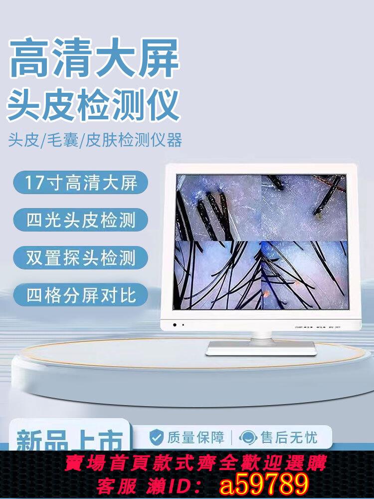 【臺灣公司 可打統編】17寸頭皮檢測儀高畫質毛囊毛發檢測防脫發養發多功能美發店專用儀器