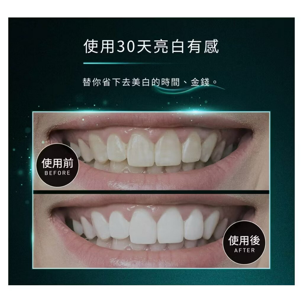 【未來實驗室】U CLEAN 亮齒微笑儀 電動牙刷 牙齒美白 潔牙 冷光 超音波 亮白 殺菌 音波 聲波 7