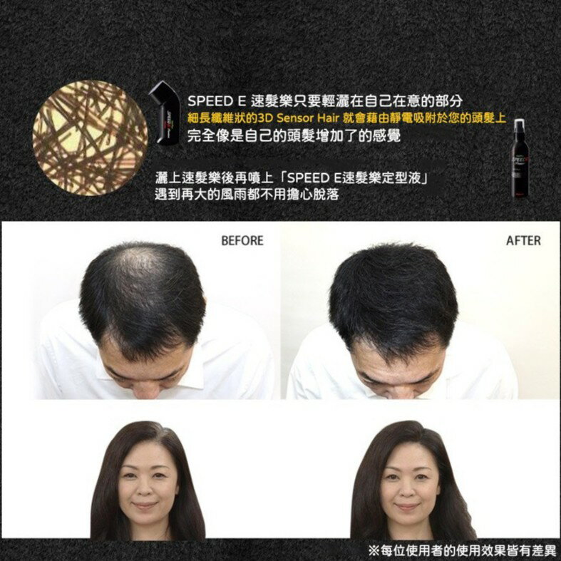 【台灣限定買二送一優惠】 SPEED E 速髮樂 增髮粉 髮際線粉 增髮纖維 補髮量 30g x3│愛德蘭絲官方旗艦店 2 【台灣限定買二送一優惠】 SPEED E 速髮樂 增髮粉 髮際線粉 增髮纖維 補髮量 30g x3│愛德蘭絲官方旗艦店 2
