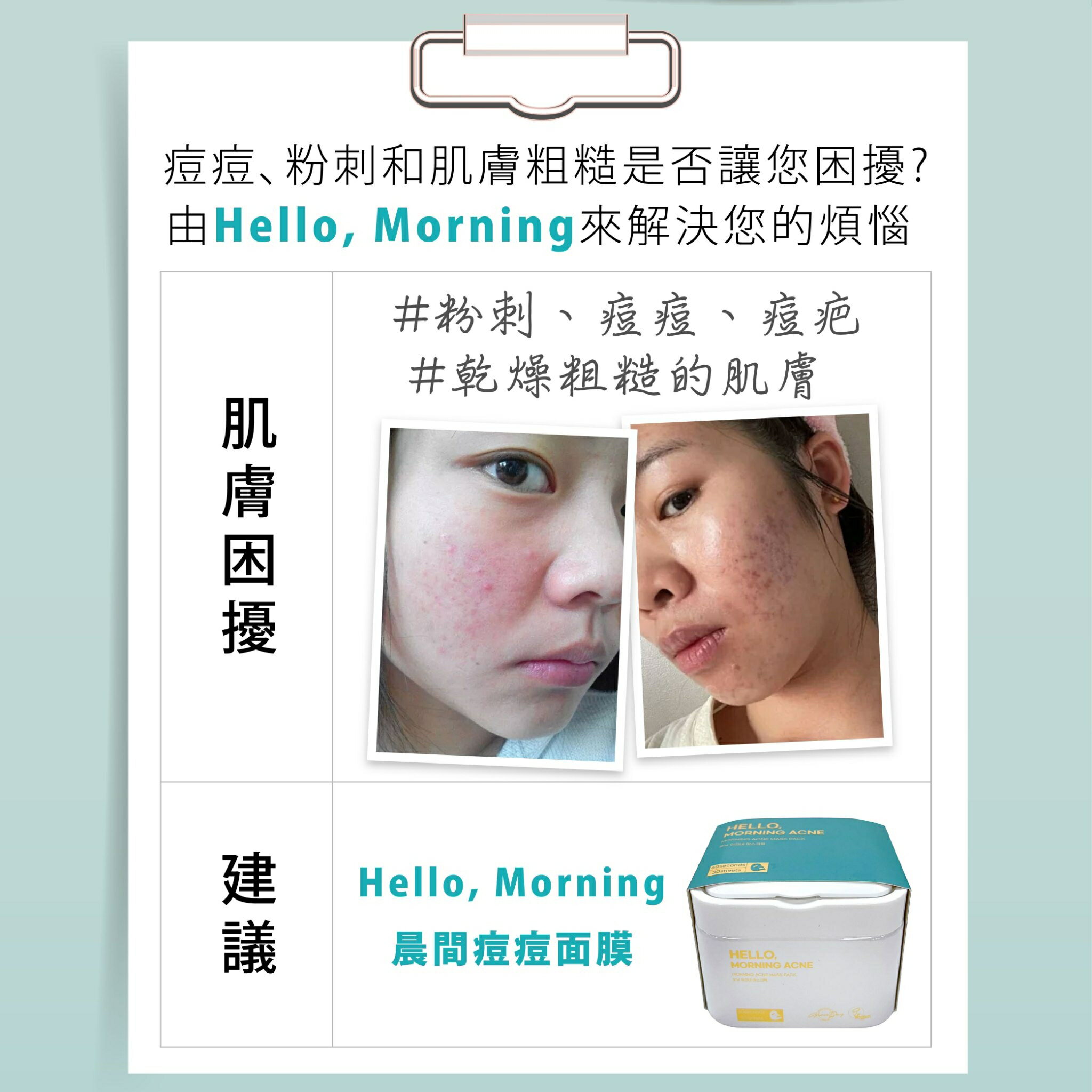 韓國面膜網友推薦【Hello, Morning】晨間痘痘面膜 30片/盒 水楊酸 早安面膜 60秒保養完成 保濕面膜 面膜 2